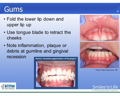 Module 7 Slide 36