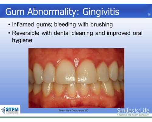 Module 7 Slide 38