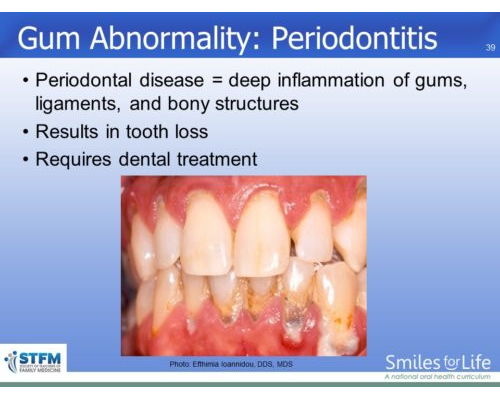 Module 7 Slide 39