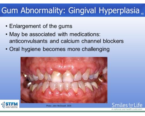 Module 7 Slide 40