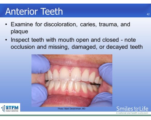 Module 7 Slide 42