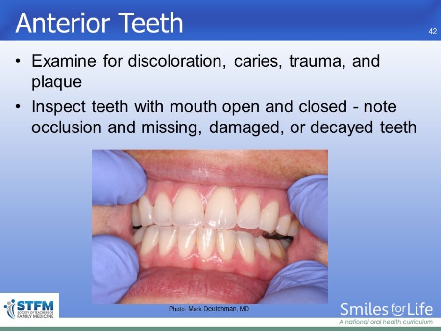 Module 7 Slide 42