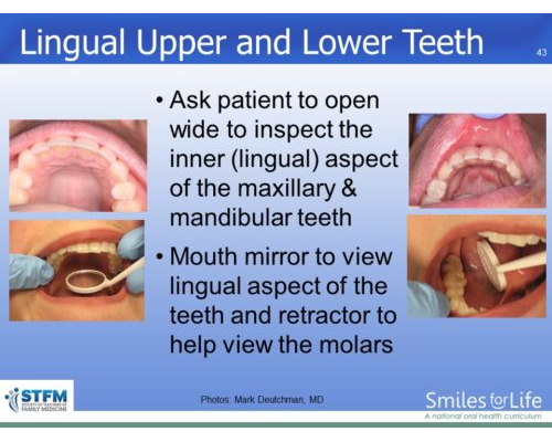 Module 7 Slide 43