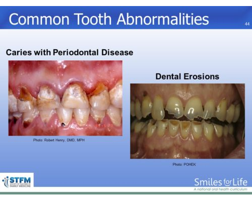 Module 7 Slide 44