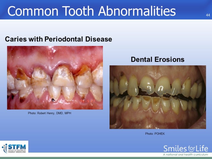 Module 7 Slide 44