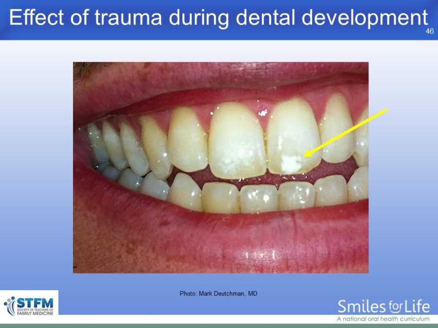 Module 7 Slide 46