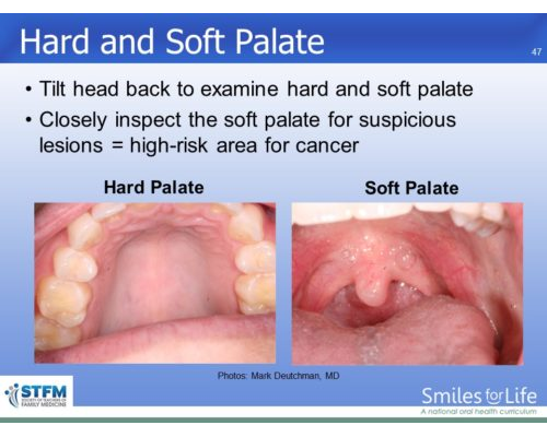 Module 7 Slide 47