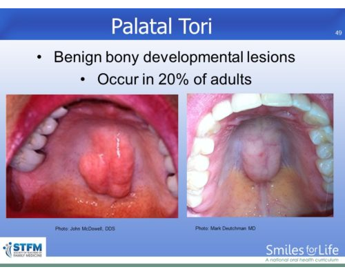 Module 7 Slide 49