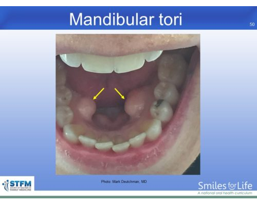 Module 7 Slide 50