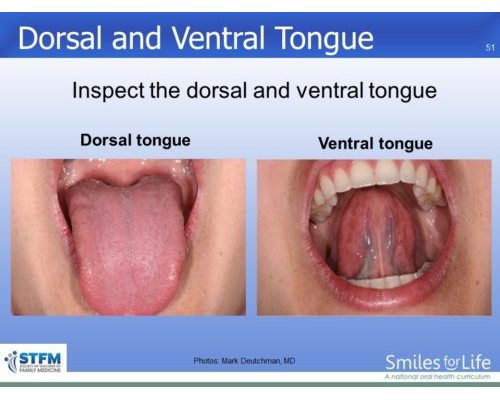 Module 7 Slide 51