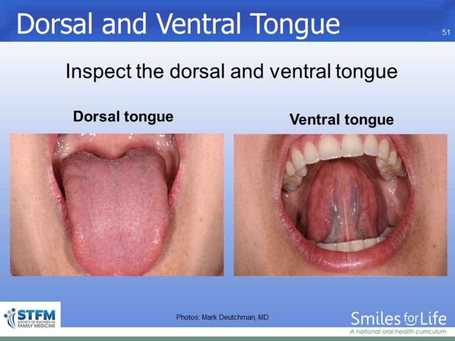 Module 7 Slide 51