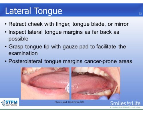 Module 7 Slide 52