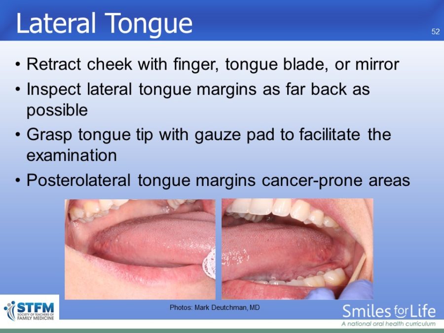 Module 7 Slide 52