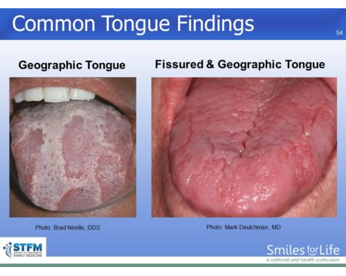 Module 7 Slide 54