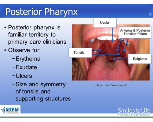 Module 7 Slide 55