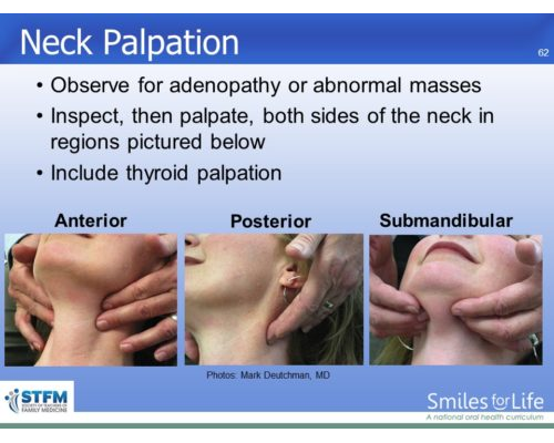 Module 7 Slide 62