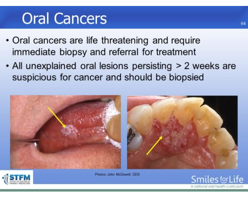 Module 7 Slide 64