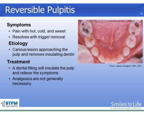 Module 4 Slide 12