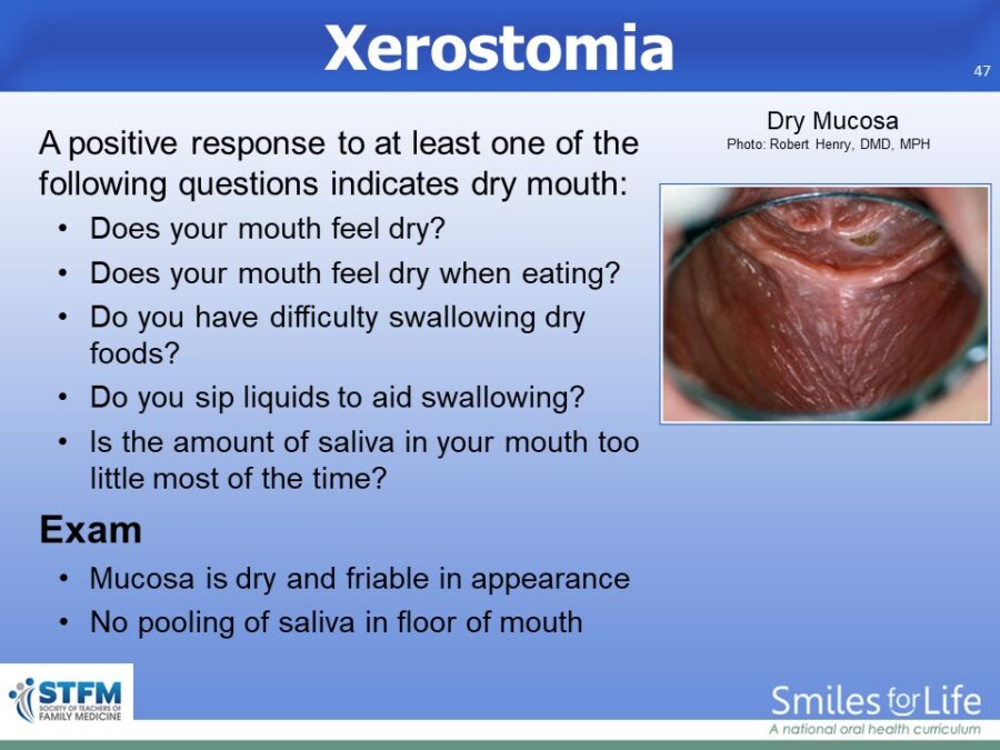Module 8 Slide 47