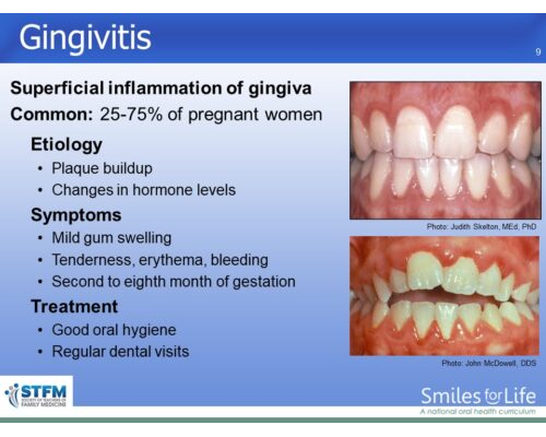 Module 5 Slide 9