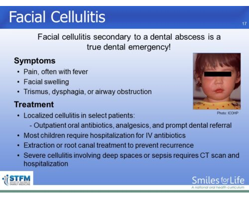 Module 4 Slide 17