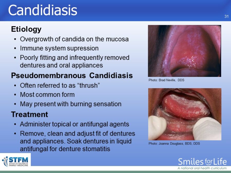 Module 3 Slide 31