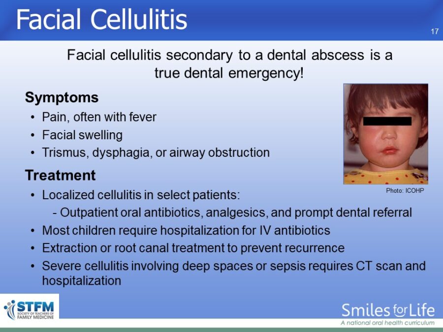Module 4 Slide 17