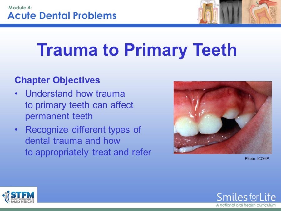 Module 4 Slide 31