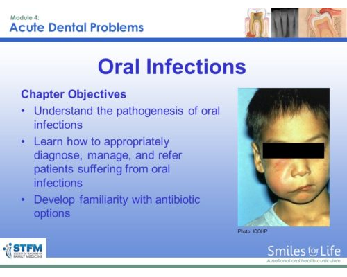 Module 4 Slide 11