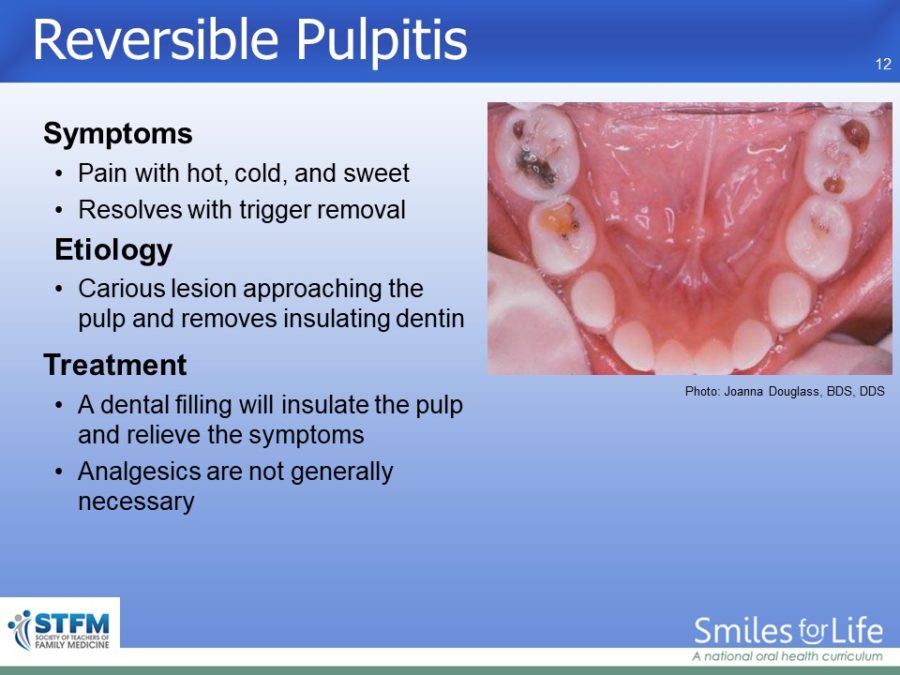 Module 4 Slide 12