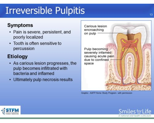 Module 4 Slide 13