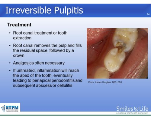 Module 4 Slide 14