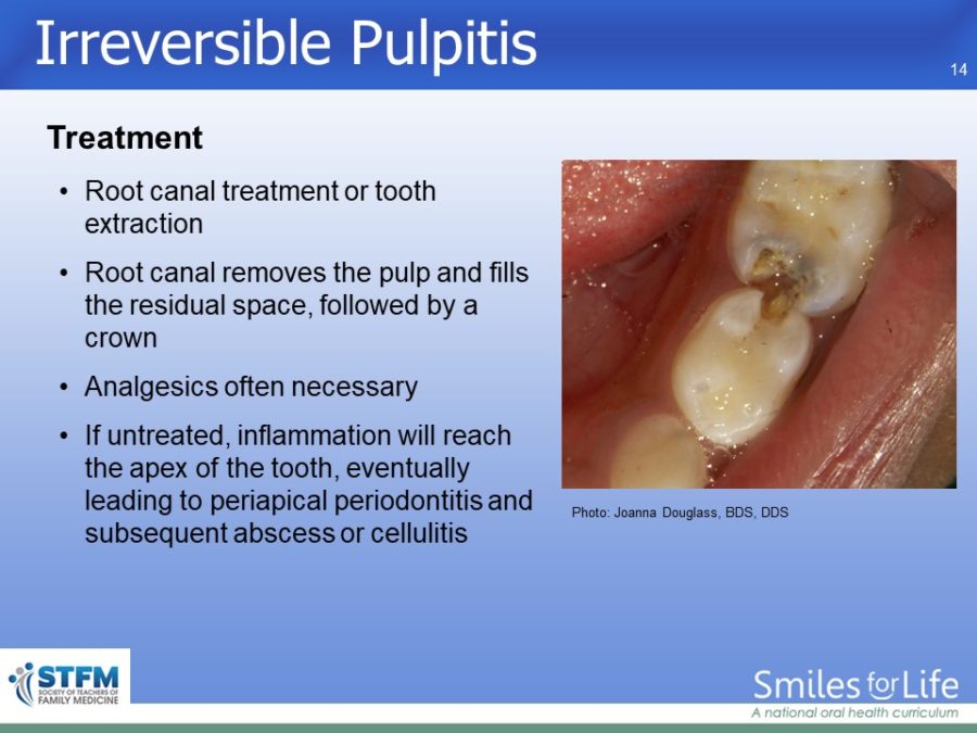 Module 4 Slide 14