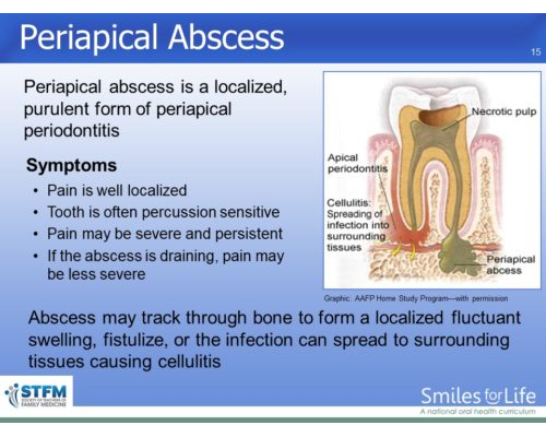 Module 4 Slide 15