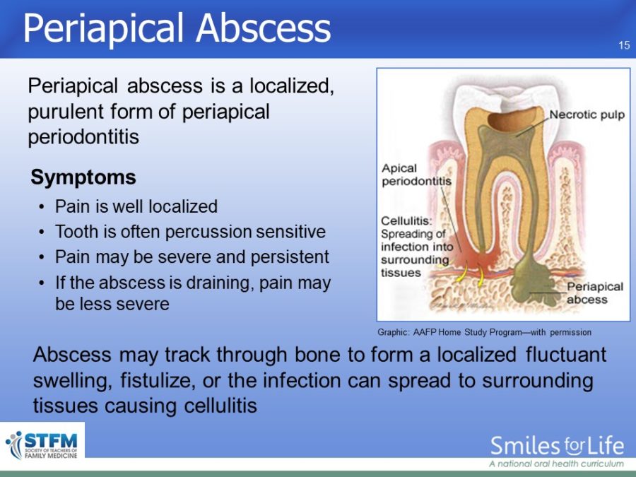 Module 4 Slide 15