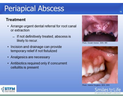 Module 4 Slide 16