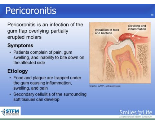 Module 4 Slide 18