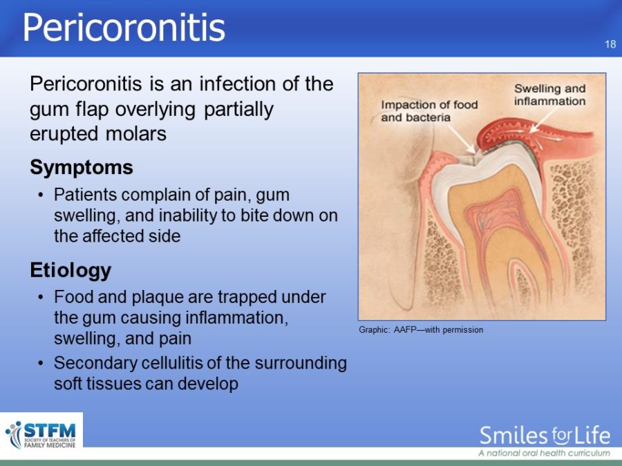 Module 4 Slide 18