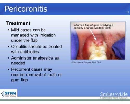 Module 4 Slide 19