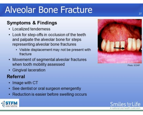 Module 4 Slide 27