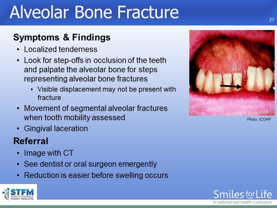 Module 4 Slide 27