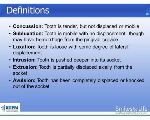 Module 4 Slide 29