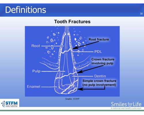 Module 4 Slide 30