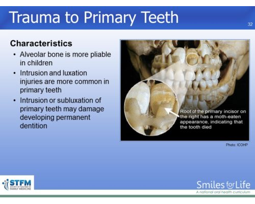 Module 4 Slide 32