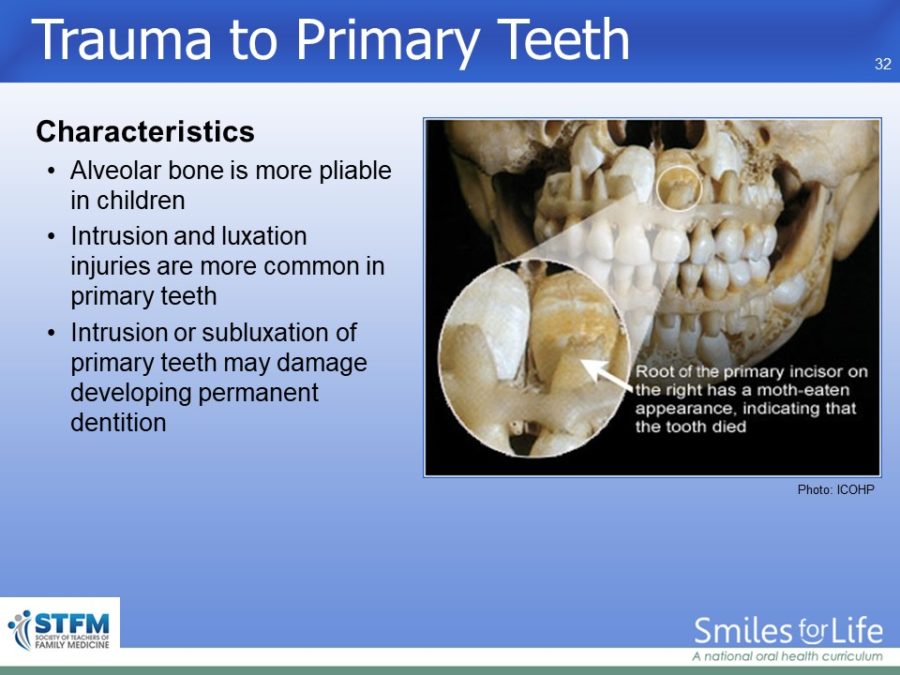 Module 4 Slide 32