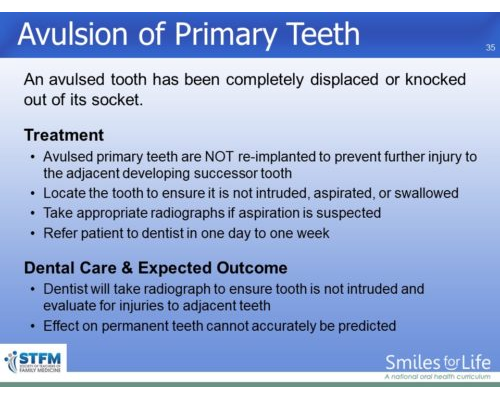 Module 4 Slide 35