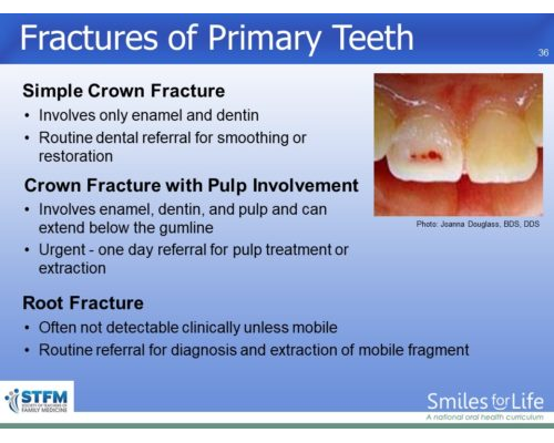 Module 4 Slide 36