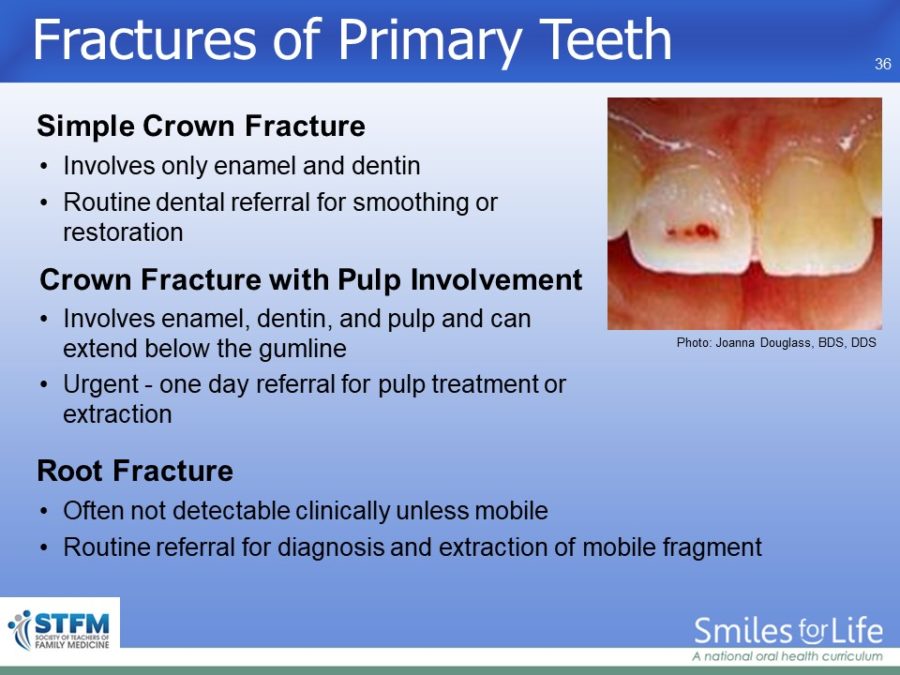 Module 4 Slide 36