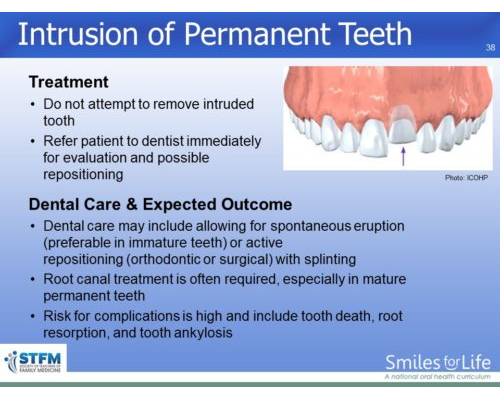 Module 4 Slide 38