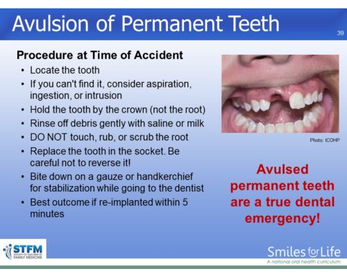 Module 4 Slide 39